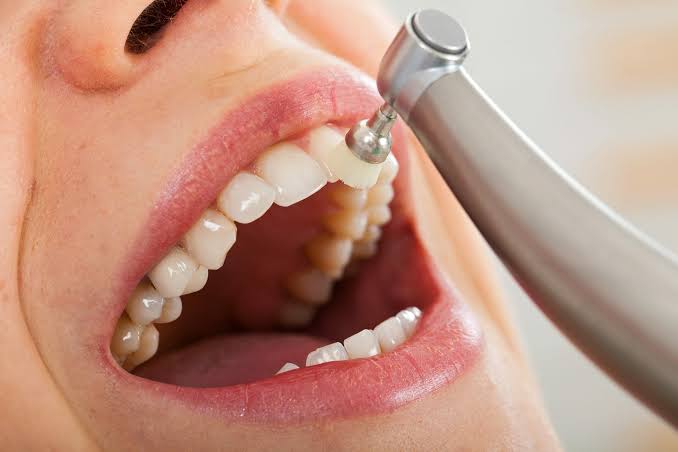 Restoring Your Oral Health with Root Canal Treatment at Bewell Medical Center