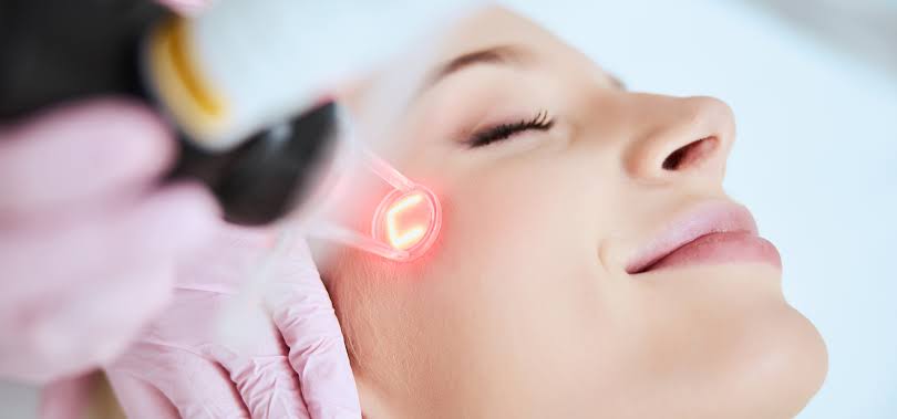 Reveal your radiant skin with Fractional Laser Treatment