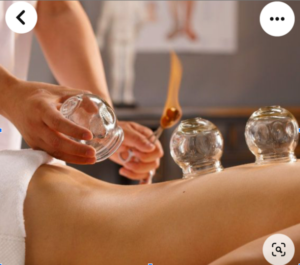 Experience the Benefits of Cupping Therapy